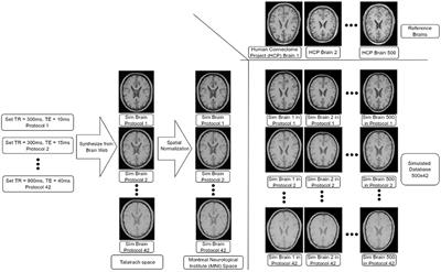 Influence of contrast and texture based image modifications on the performance and attention shift of U-Net models for brain tissue segmentation